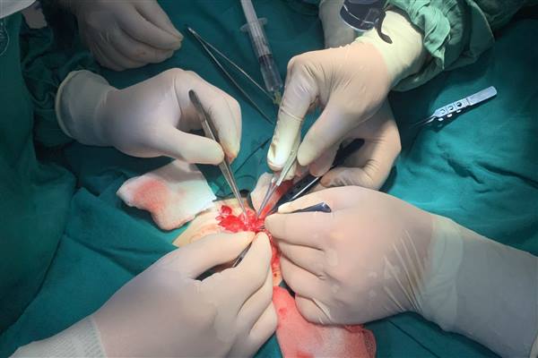 Bệnh viện Nhi Hải Phòng phẫu thuật thành công trường hợp bệnh nhi bị đứt rời dương vật