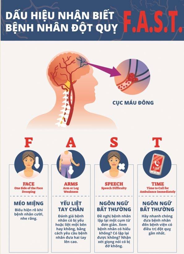 Những dấu hiệu cảnh báo tai biến mạch máu não