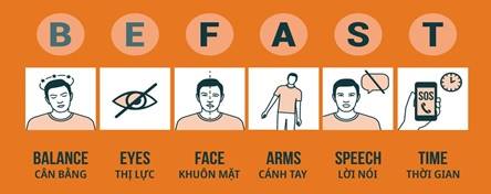 Đột quỵ não ngày càng trẻ hoá