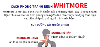 Tăng cường phòng, chống bệnh Whitmore