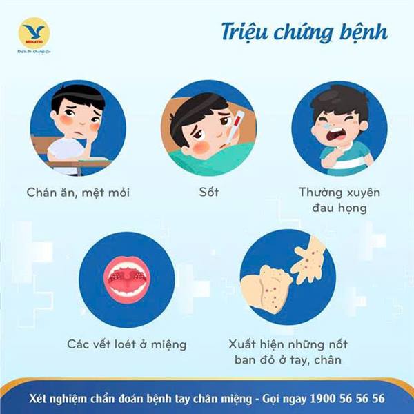 Tăng cường phòng, chống bệnh tay chân miệng.