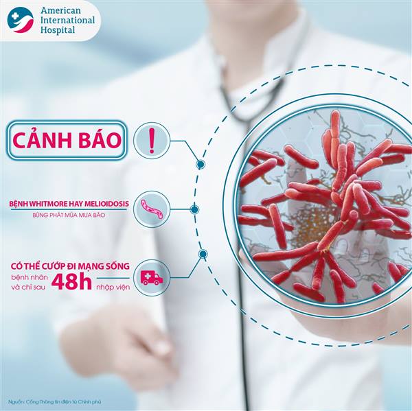 CẢNH BÁO: BỆNH WHITMORE BIẾN CHỨNG NGUY HIỂM – ĐỪNG CHỦ QUAN KHI TIẾP XÚC VỚI ĐẤT, NƯỚC BẨN