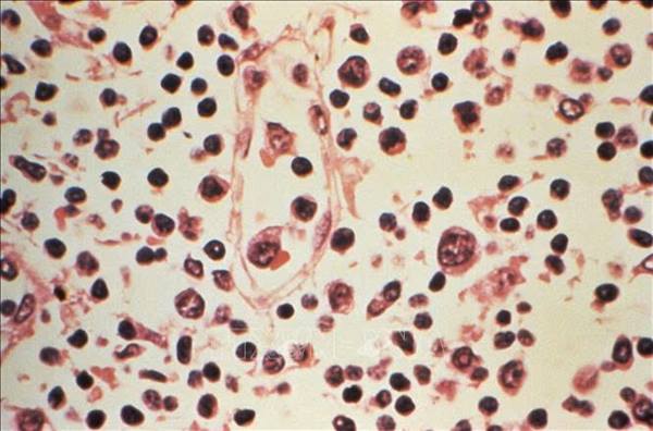CHILE CẢNH BÁO SỐ CA NHIỄM VIRUS HANTA GIA TĂNG VỚI TỶ LỆ TỬ VONG CAO