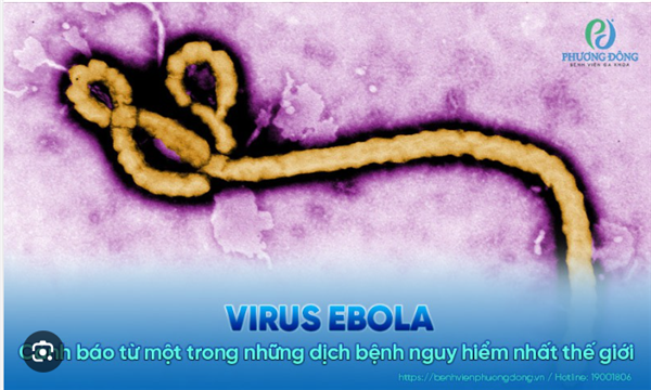 V/v chủ động giám sát phát hiện
và triển khai các biện pháp phòng,
chống dịch bệnh do vi rút Ebola
trên địa bàn xã Tứ Kỳ