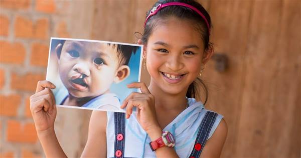 UBND phường Tứ Minh triển khai chương trình phẫu thuật dị tật vùng hàm mặt cho trẻ em 